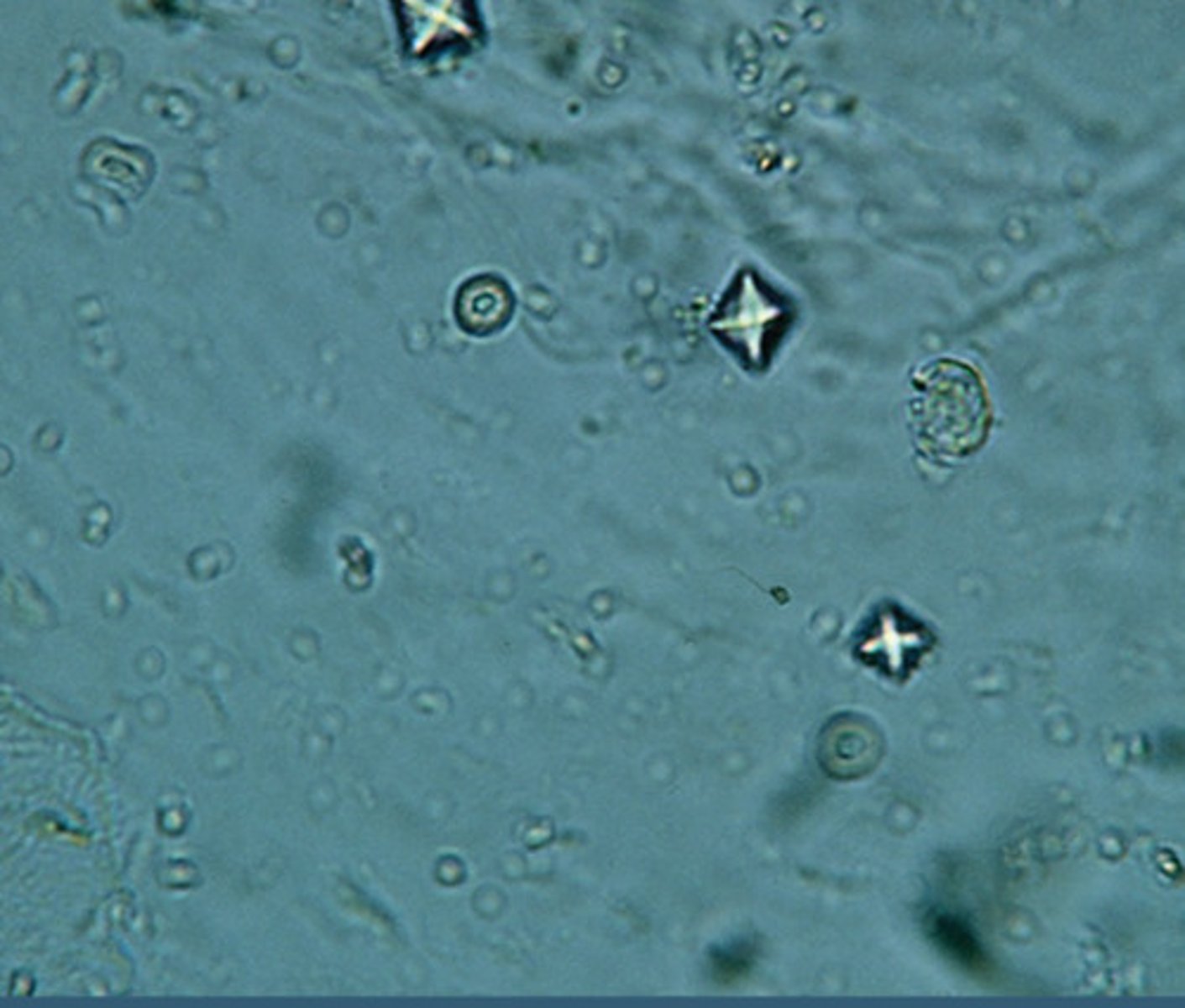<p>Small Square crystals with Central Cross</p><p>Most Common Stone Type</p>