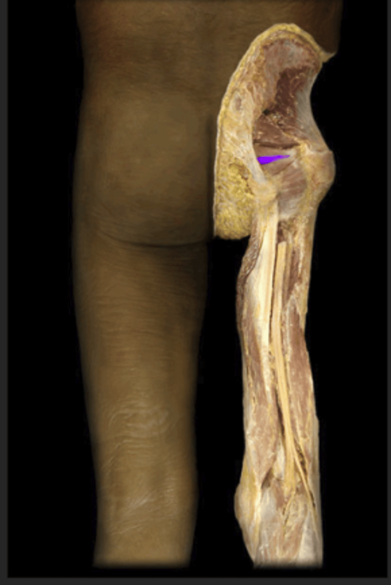 <p>Origin: Inner surface of obturator foramen</p><p>Insertion: Greater trochanter</p>