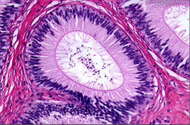 <p>= parte din p. apical microvili imobili și foarte lungi (ex: epiteliul din tractul genital maculin)</p>