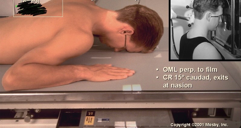 <p>What position is this?</p>