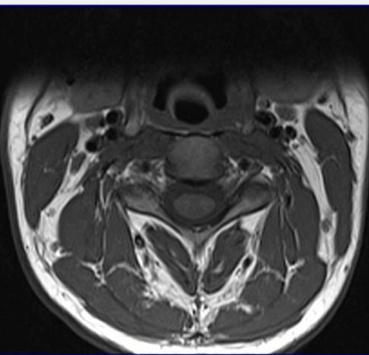 <p>What type of MRI view does this show?</p>