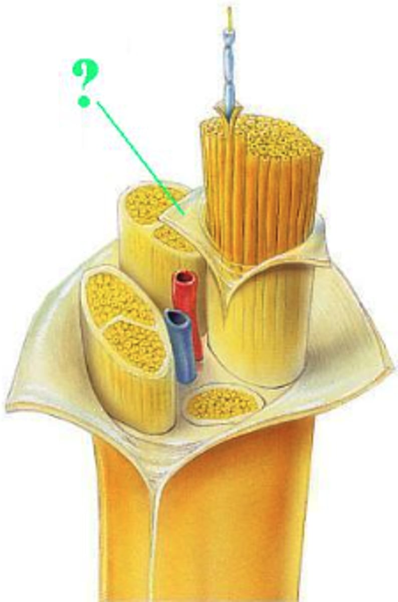 <p>perineurium</p>