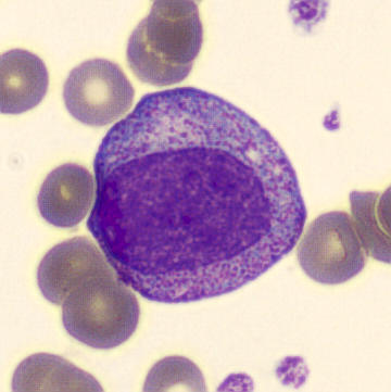 <ul><li><p>size: 15-22 um</p></li><li><p>N:C ratio is 3:1, nucleus is oval/round, eccentric, and dark purple</p></li><li><p>cytoplasm is blue with fine to large blue-red granules</p></li><li><p>CD45, CD33, CD13, &amp; CD15</p></li></ul><p></p>