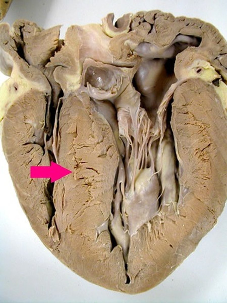 <p>Identify the structure that divides the two ventricles.</p>