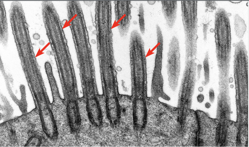 <p>ID the border modification.</p>