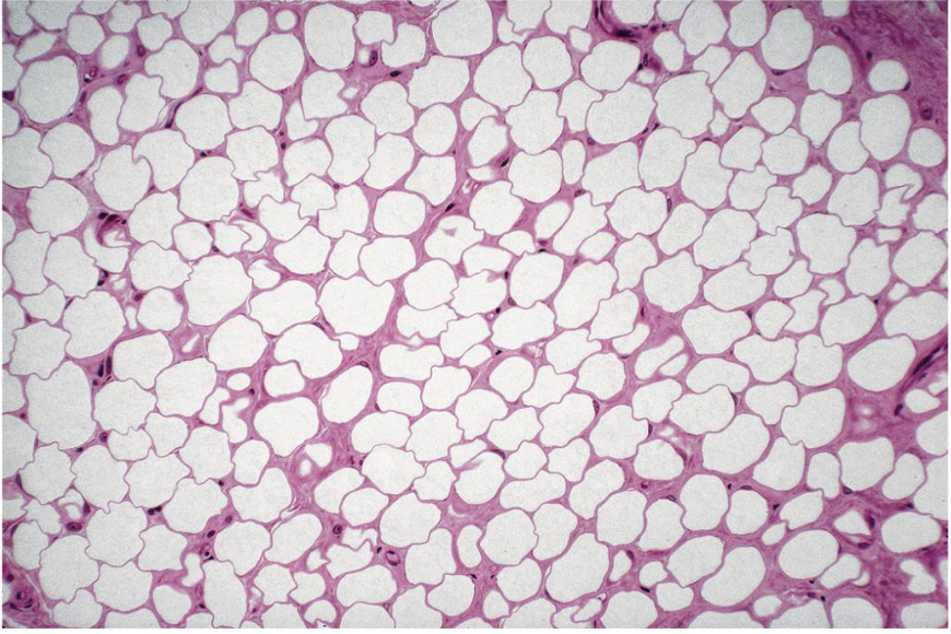 <p>what tissue is this</p>