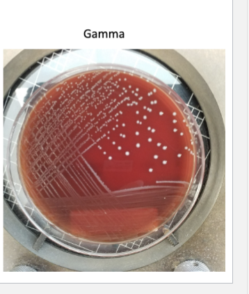 <p>Gamma (γ) hemolysis</p>