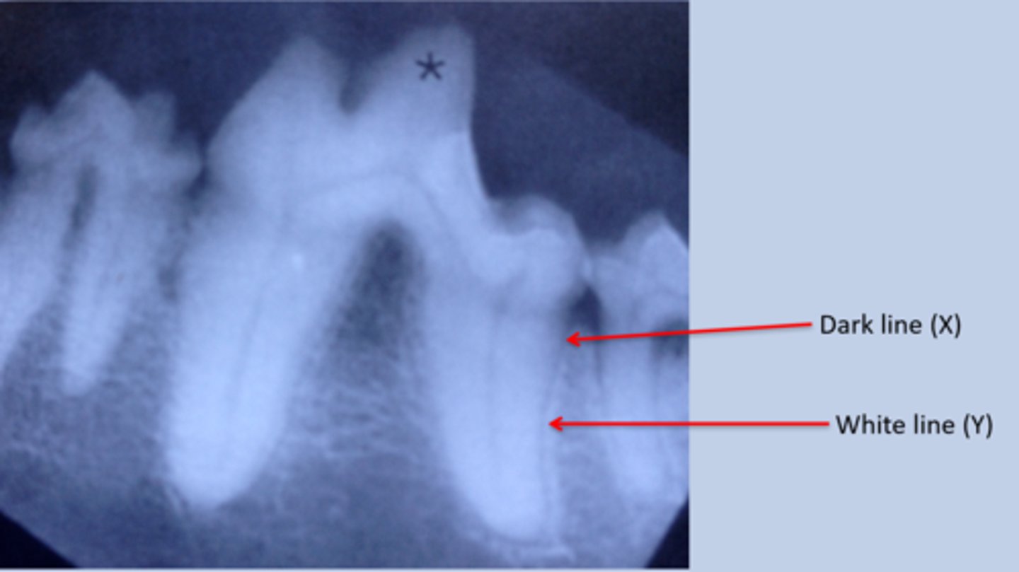<p>Label this radiograph</p>
