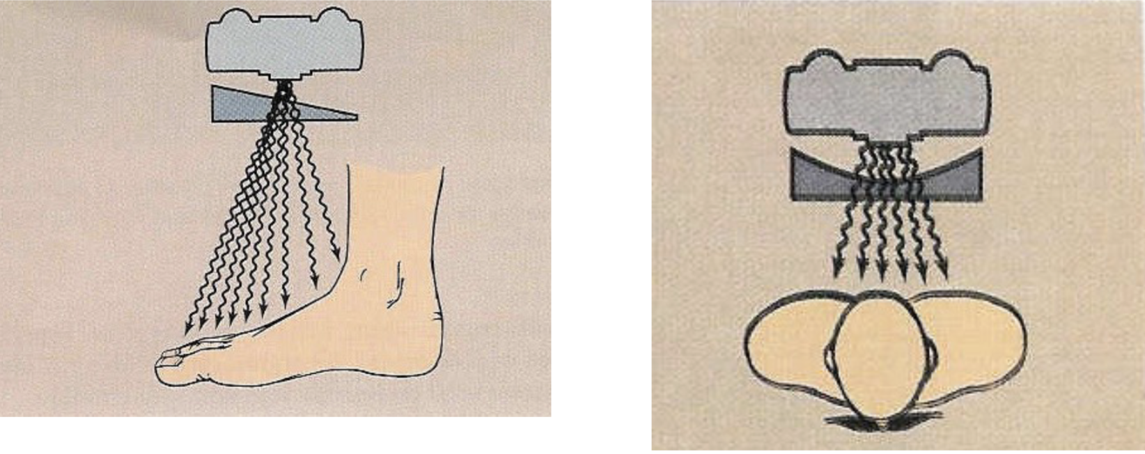 <p><span style="color: rgb(255, 255, 255);"><span>• Compensates for differences in tissue thickness</span></span><span style="color: rgb(255, 255, 255);"><br></span><span style="color: rgb(255, 255, 255);"><span>• Examples: wedge, trough</span></span></p>