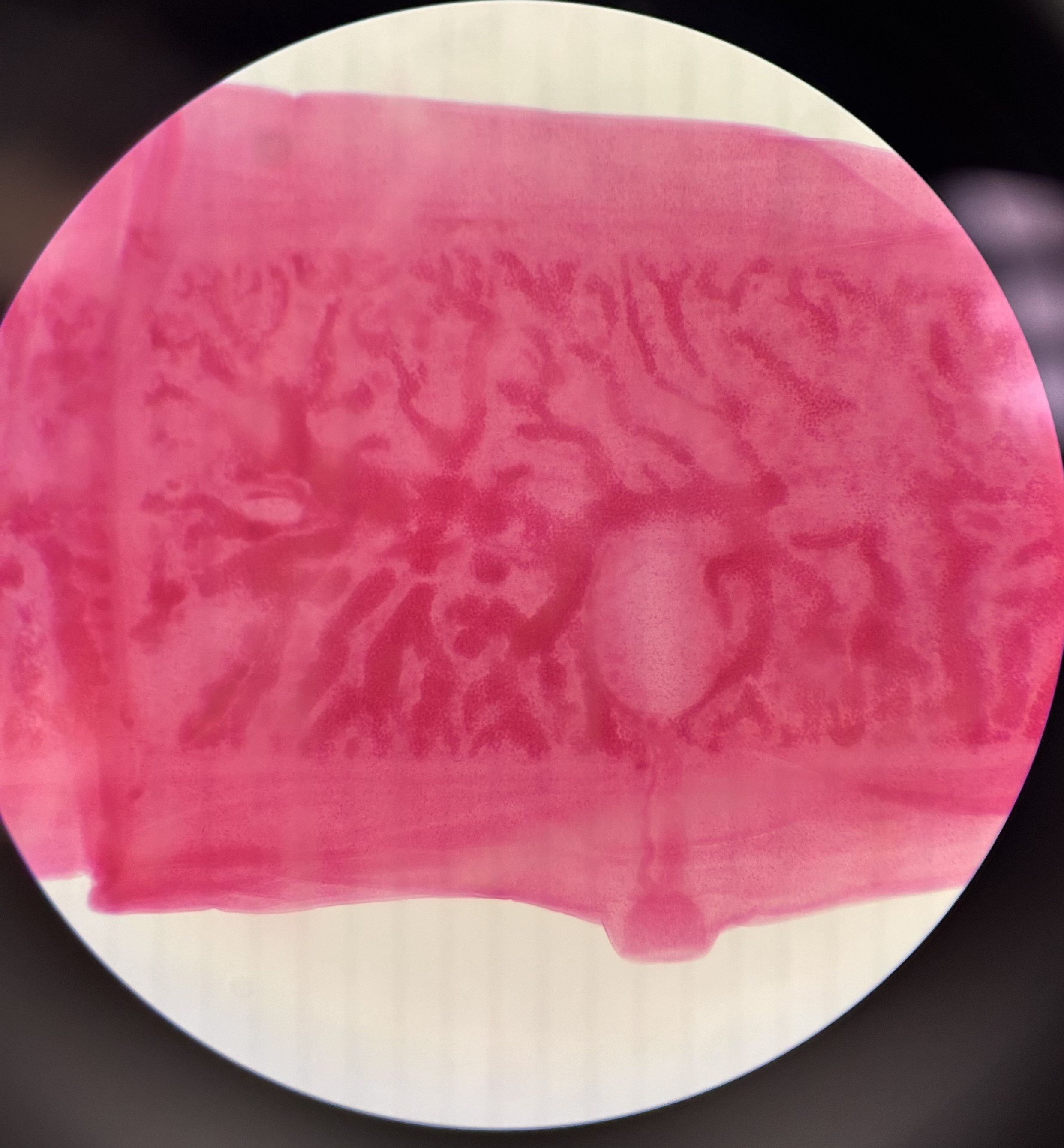 <p>Identify the organism and the Class it belongs to</p>