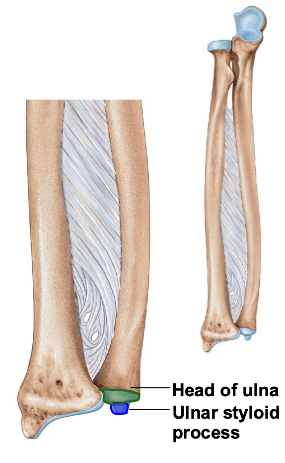 <p>Styloid process of ulna</p>