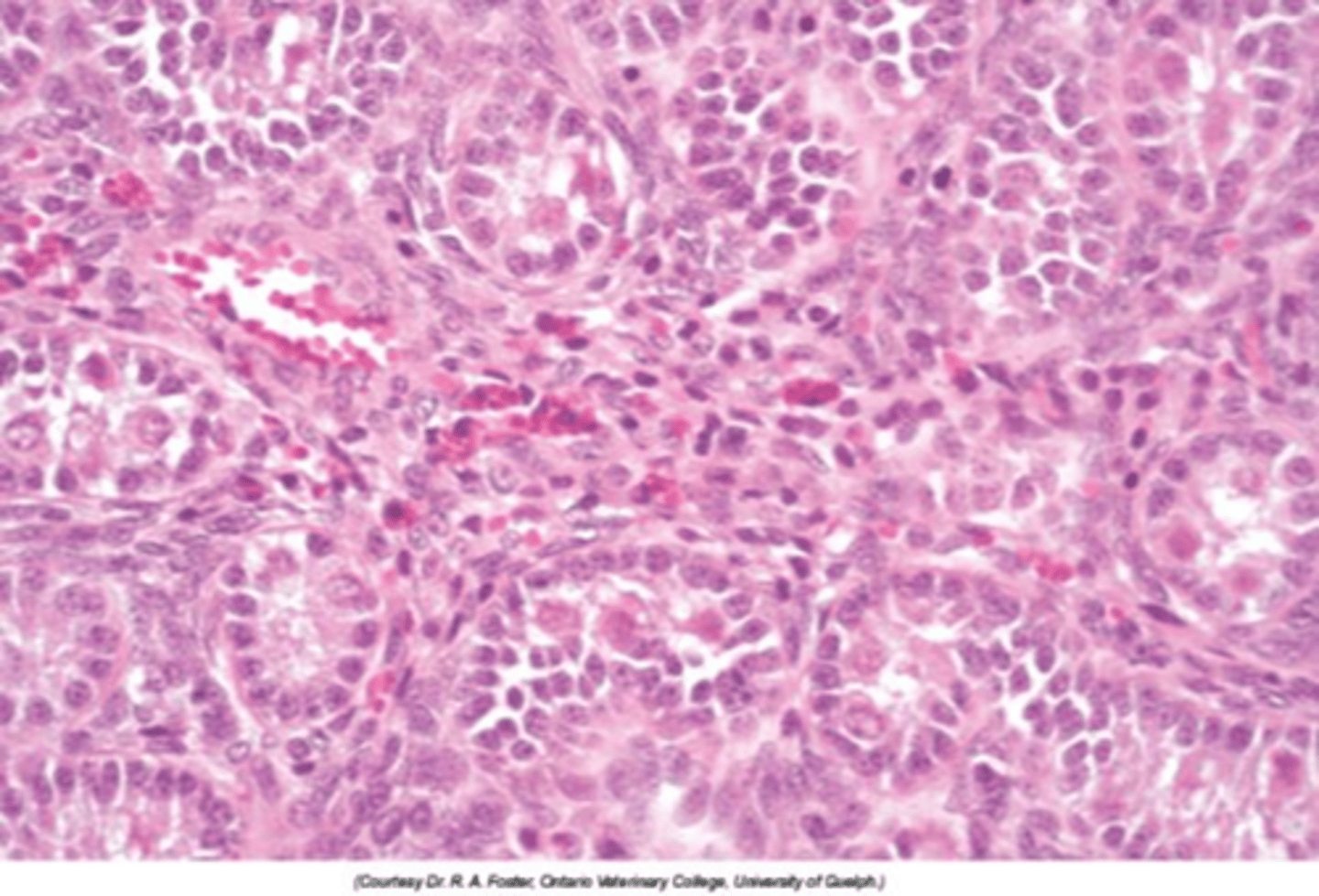 <p>Describe the histological appearance of testicular hypoplasia</p>