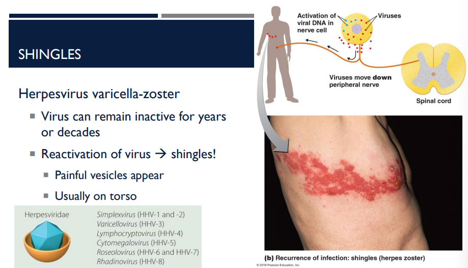 <p>A person has shingles. Where do the painful vesicles usually appear?</p>