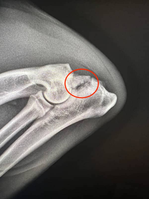 <p>Radiography: In young dogs there is a thin, linear radiolucent (black) space between the anconeal process and the rest of the olecranon. In older dogs the anconeal process is often completely detached</p>