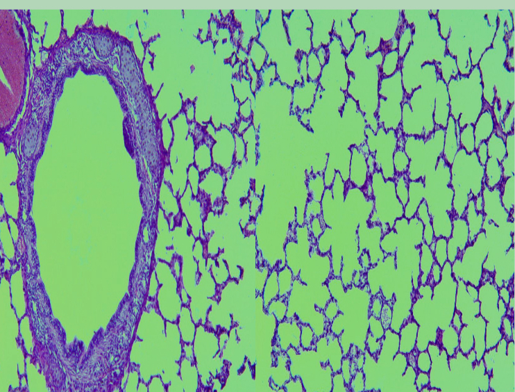 <p>What organ is identified in the slide showing lobar bronchus and alveoli?</p>