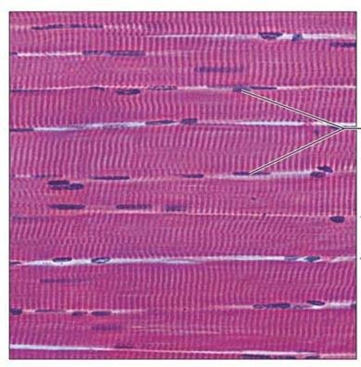 <p>Voluntary, striated muscle attached to bones, with muscle fibers in the form of long cylinders running parallel to each other and being multinucleated.</p>