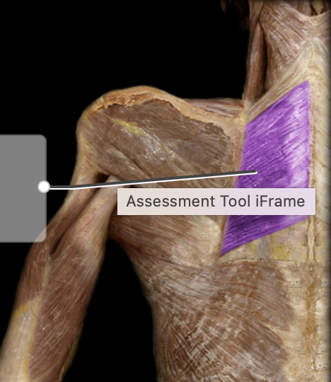 <p>Insertion of Rhomboids</p>