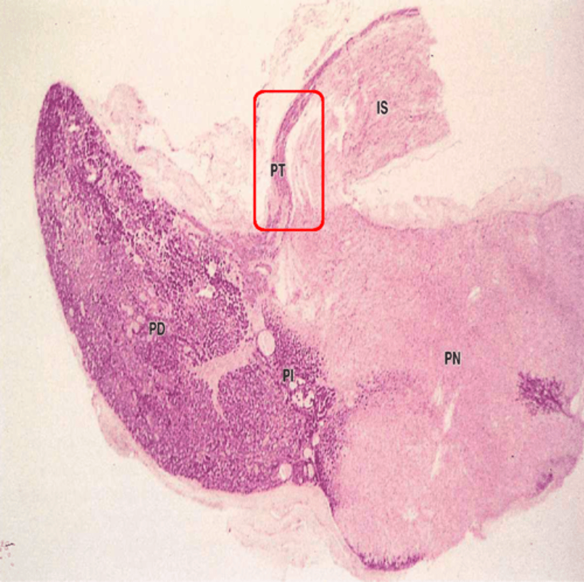 <p>What part of the pituitary:</p><p>-part of anterior pituitary that wraps around the infundibulum</p><p>-composed of epithelial tissue within a thin wrapping of connective tissue</p>