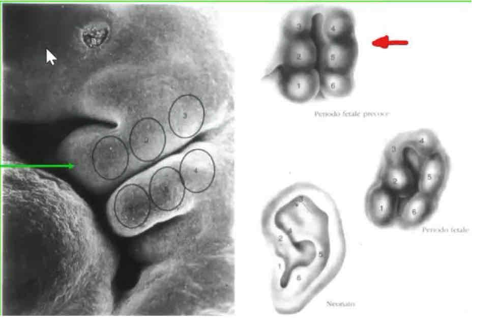 <p>L’ectomesenchima prolifera formando 3 tubercoli auricolari per arco.</p><p>Il solco faringeo fra i due gruppi di tubercoli si introflette e evolverà nel meato acustico esterno. Le altre strutture dei tubercoli poi formeranno il padiglione auricolare crescendo in modo differenziale fra loro.</p>