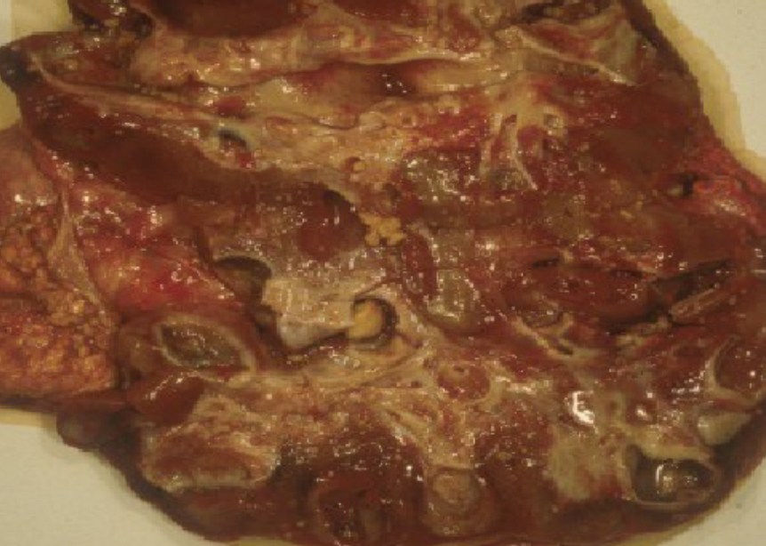 <p>UTI in cattle, cystisis, pyeloneprhitis </p>