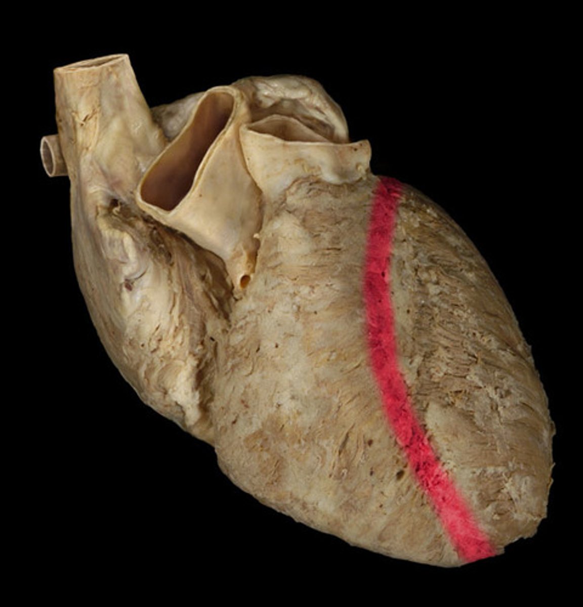 <p>the junction between right and left ventricles</p><p>anterior side (depression)</p>
