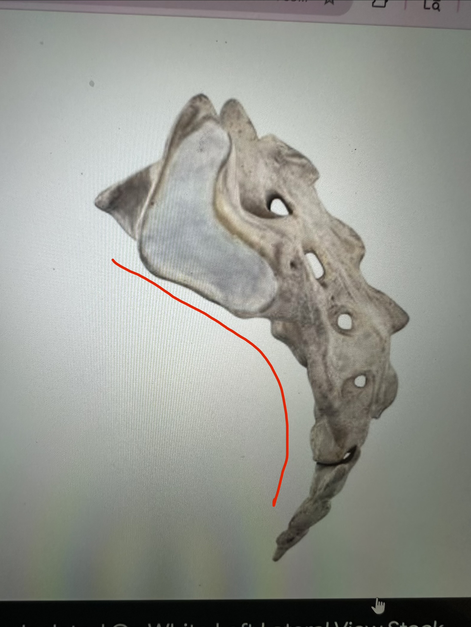 <p>sacrum, scoliosis edge of scoliosis</p>