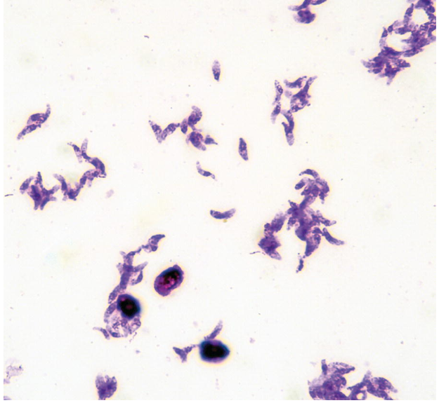 <p>What are morphology features of Toxoplasma tachyzoites?</p>