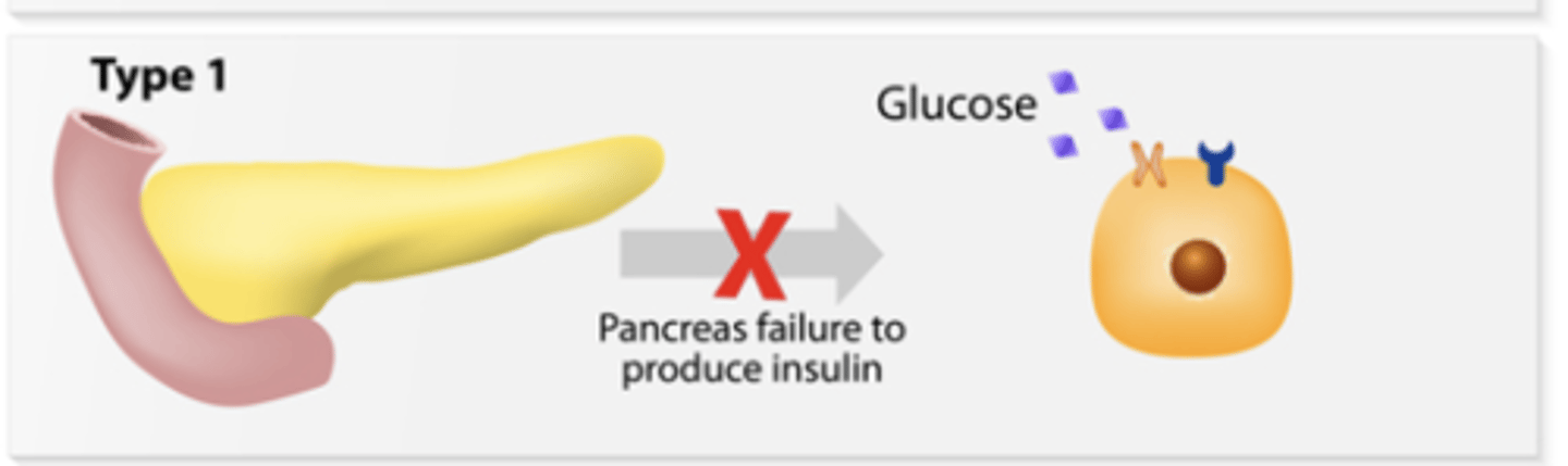 <p>occurs when the pancreas is unable is unable to produce enough insulin </p><p>tends to develop at a young age </p><p>cannot be prevented </p><p>required insulin therapy </p>