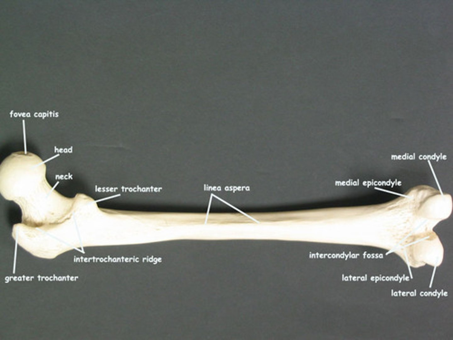 <p>Narrow ridge of bone, less prominent than a crest (Ex: linea aspira)</p>