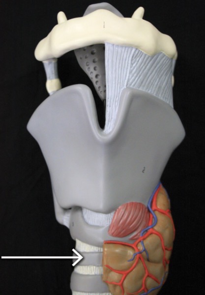 <p>The <strong><em><em></em></strong></em>__ provides structure to the trachea and prevents it from collapsing.</p>