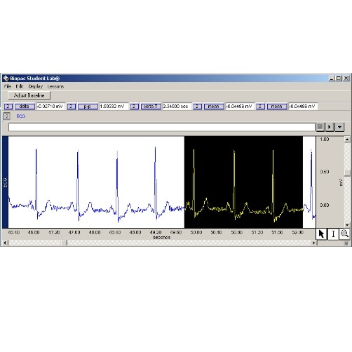 <p><span>Select the correct setup of values for computing heart rate in BPM from the highlighted data.</span></p>