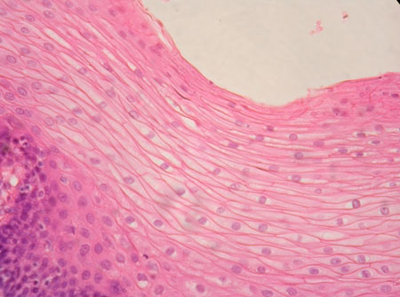 <p>What type of epithelium is shown in the image?</p>