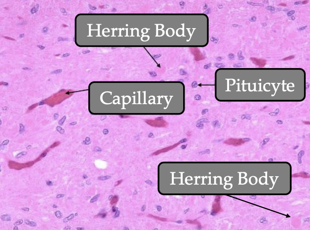 <p><strong><u>What:</u></strong> The <span style="color: blue;"><strong><span>posterior pituitary</span></strong></span></p><p><strong><u>Function:</u></strong> <span style="color: blue;"><strong><span>Stores</span></strong></span><strong> </strong>and<span style="color: blue;"> <strong>releases hormones</strong></span><strong> </strong>made in the <span style="color: green;"><strong>hypothalamus</strong></span></p><p><strong><u>Where and what are the cell bodies of neurohypophyseal hormones located:</u></strong></p><ul><li><p><strong><u>Where:</u></strong> In the <span style="color: green;"><strong>hypothalamus</strong></span></p></li><li><p><strong><u>What:</u></strong></p><ul><li><p><span style="color: green;"><strong>Supraoptic nuclei</strong></span></p></li><li><p><span style="color: green;"><strong>Paraventricular nuclei</strong></span></p></li></ul></li></ul><p><strong><u>Which hormones are associated with neurohypophysis:</u> </strong><span style="color: blue;"><strong>ADH</strong></span><strong> </strong>(<em>antidiuretic hormone</em>) and <span style="color: blue;"><strong>oxytocin</strong></span></p><ul><li><p><strong><u>Are they produced in the neurohypophysis:</u> </strong><span style="color: blue;"><strong>No</strong></span>,</p><ul><li><p>They are <span style="color: blue;"><strong>produced</strong></span><strong> </strong>in the <span style="color: blue;"><strong>hypothalamus</strong></span><strong> </strong>and</p></li><li><p><span style="color: green;"><strong>Stored</strong></span><strong> </strong>and <span style="color: green;"><strong>released</strong></span><strong> </strong>from the <span style="color: green;"><strong>neurohypophysis</strong></span></p></li></ul></li></ul><p><strong><u>Where are these hormones stored:</u> </strong>Neurosecretory granules called <span style="color: blue;"><strong>Herring bodies</strong></span></p><p><strong><u>What is pars nervosa:</u></strong> The <span style="color: blue;"><strong>main part </strong></span>of the <span style="color: blue;"><strong>neurohypophysis</strong></span><strong> </strong>contain</p><ul><li><p><strong><u>Contains:</u></strong></p><ul><li><p><span style="color: blue;"><strong>Terminal axons</strong></span></p></li><li><p><span style="color: blue;"><strong>Surrounding pituicytes</strong></span><strong> </strong>(<em>support cells with lipid droplets &amp; cytoplasmic projections</em>)</p></li></ul></li></ul><p><strong><u>In which animals is the neurohypophysis larger than adenohypophysis:</u></strong> <span style="color: blue;"><strong>Feline</strong></span><strong> </strong>and <span style="color: blue;"><strong>porcine</strong></span></p><p></p>