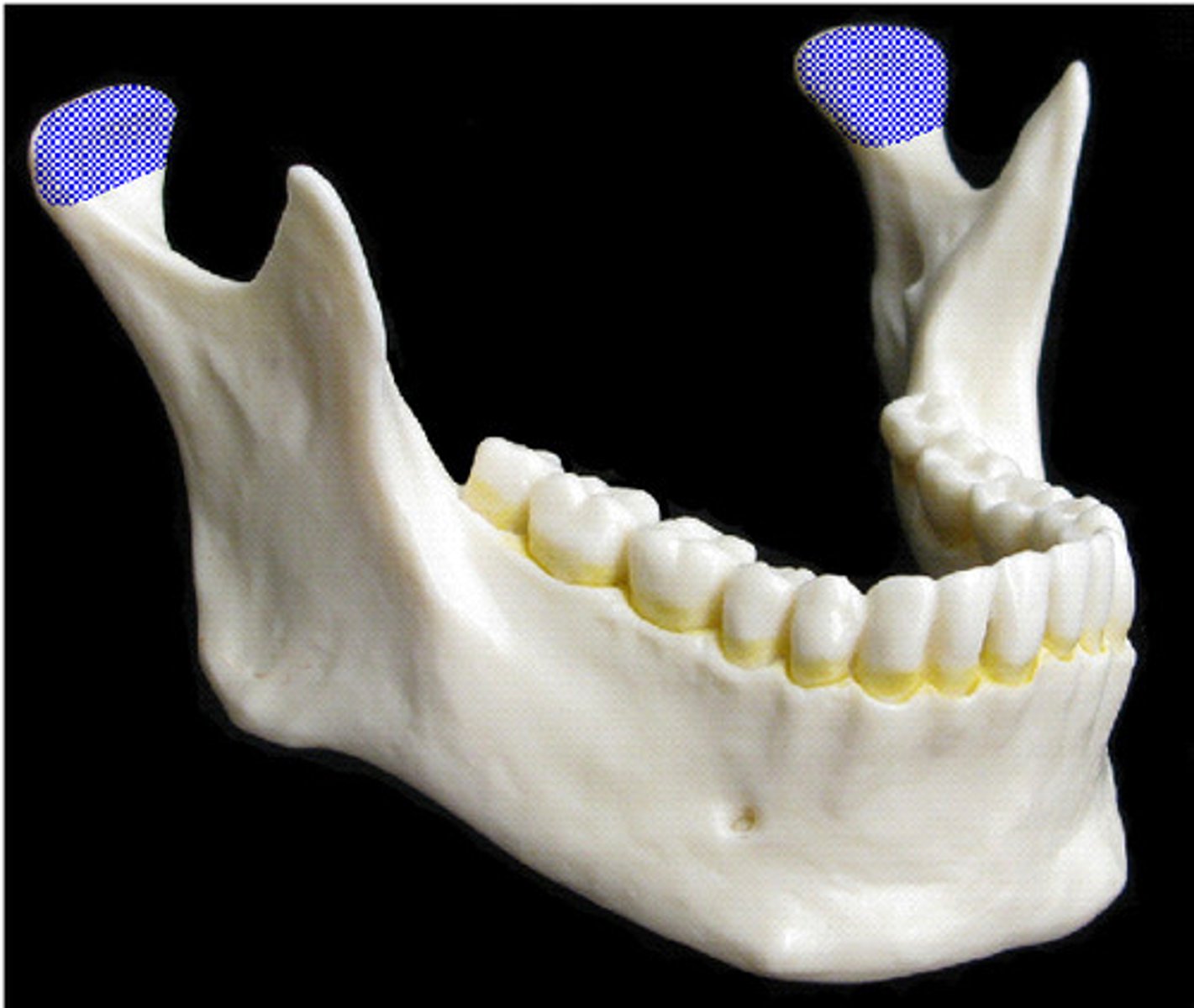 <p>Articulation point of the mandible with the mandibular fossa of the temporal bone</p>
