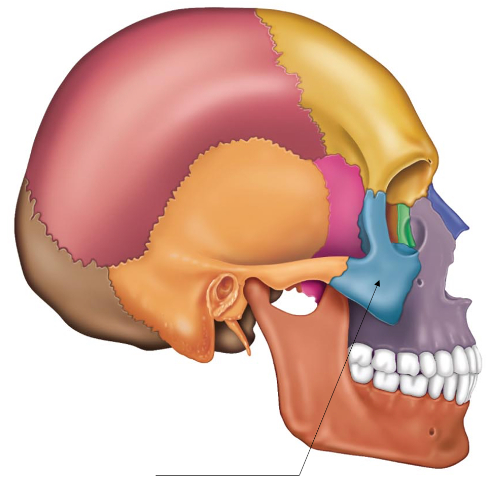 term image