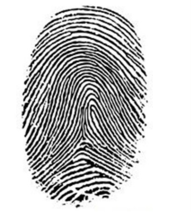 <ul><li><p>Ridges enter and exit from the same direction with a center core</p></li><li><p>Most common</p></li><li><p>Has one or more ridges that enter and exit on the same side</p></li><li><p>1 delta</p></li></ul><p></p>