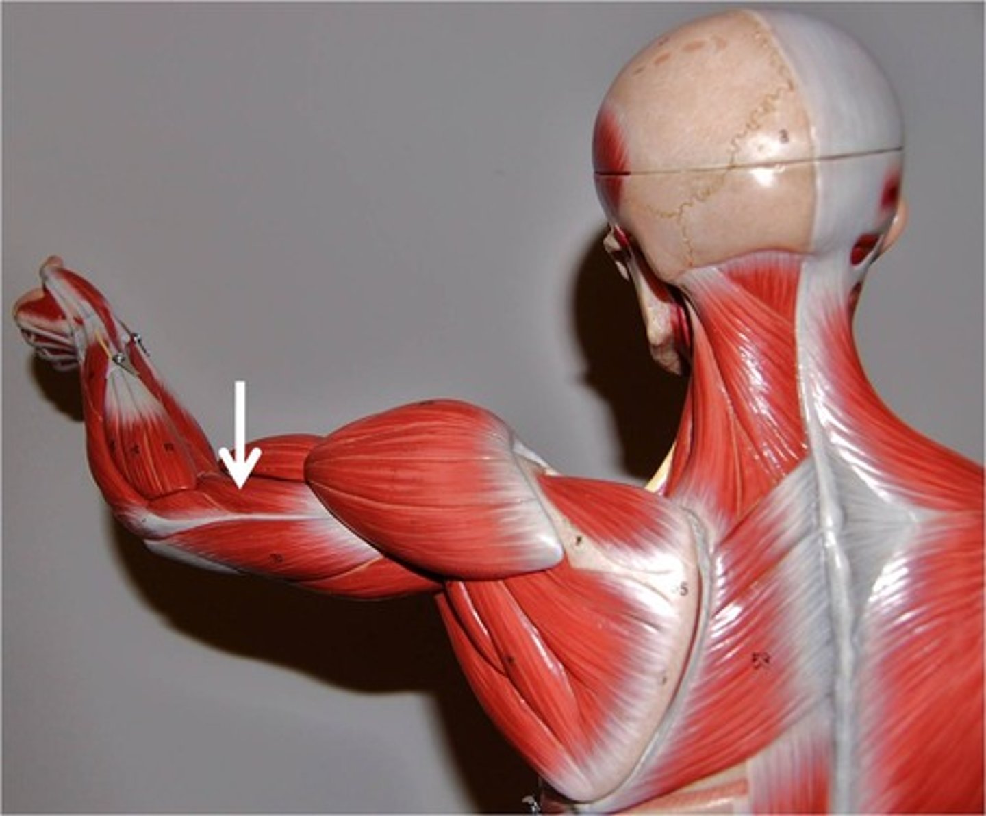 <p>origin: humerus</p><p>insertion: ulna</p><p>action: flexes elbow</p>