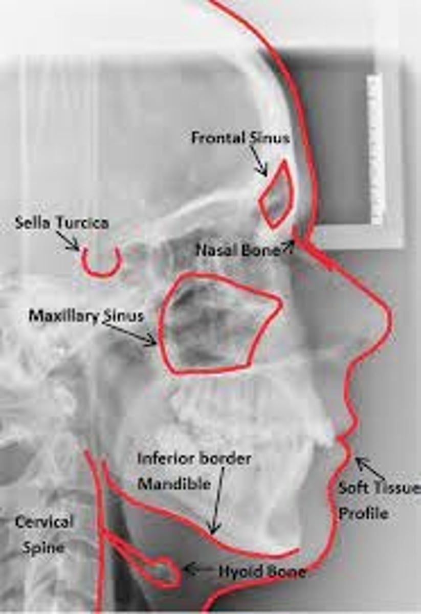 <p>enables the dentist to capture a complete radiographic image of the side of the face</p>