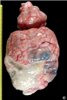 <p>Cellular and architectural detail is lost leaving a liquid mass </p><p>Common in CNS </p>