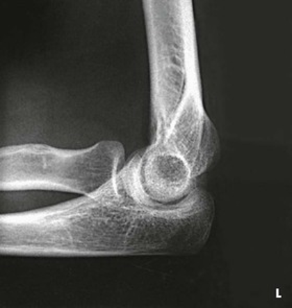 <p>What position would the hand be in for this radiograph</p>