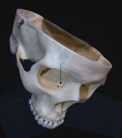 name the bone 