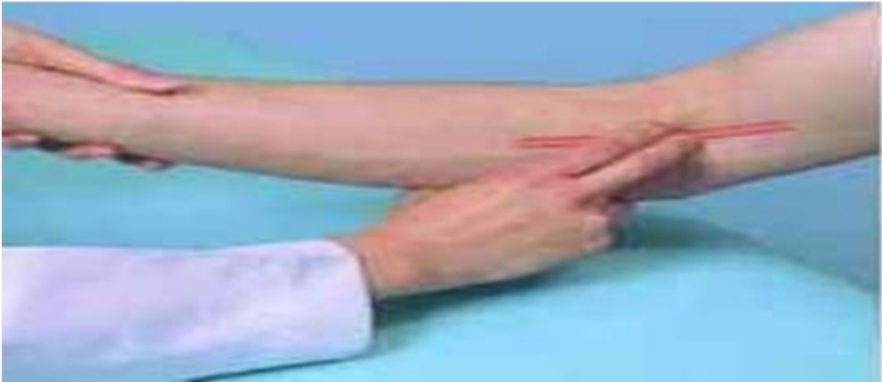 <p>Identify the pulse examined at the cubital fossa.</p>