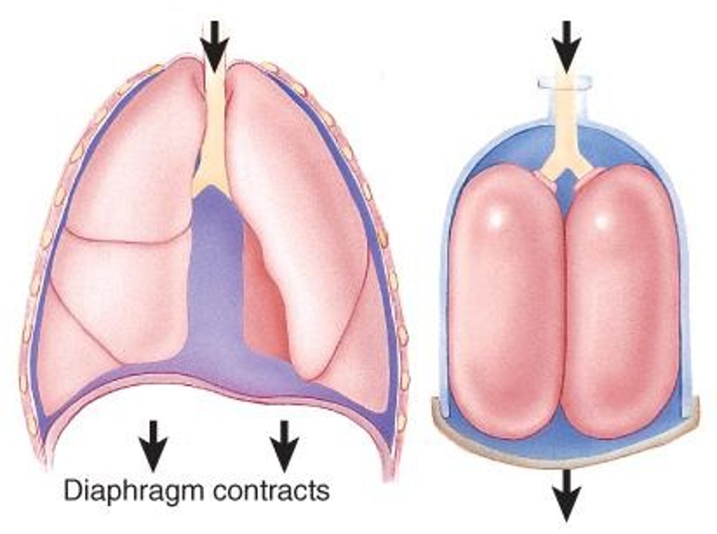 <p>Mechanical assistance for patient breathing.</p>