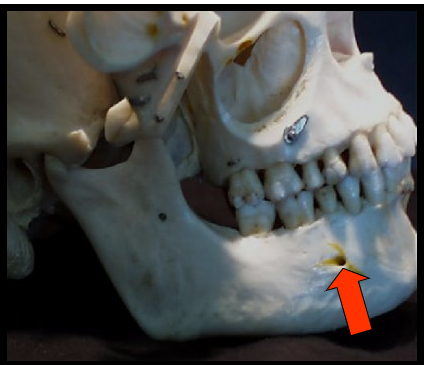 <p><span>An opening or hole in bone located on the external surface of the mandible in the region of the mandibular premolars.</span></p>