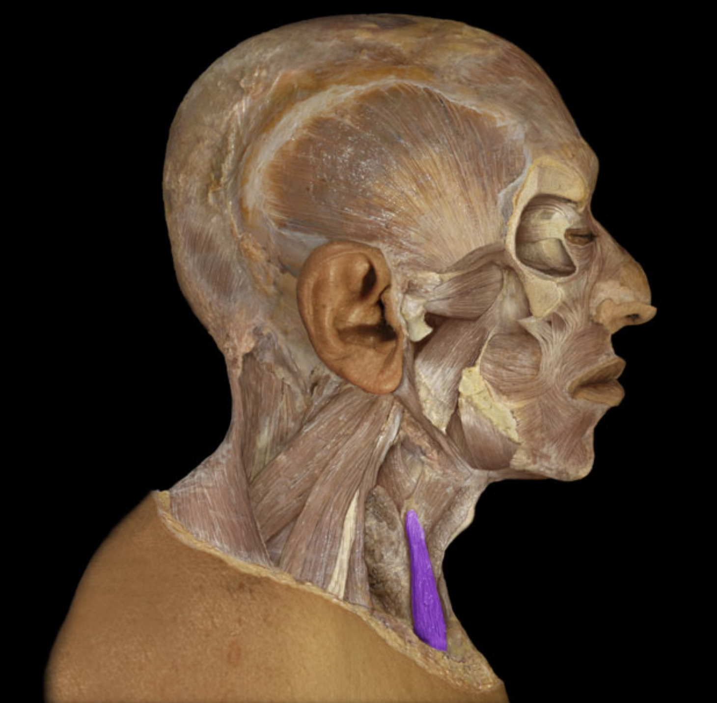 <p>What is/are this muscle’s insertion(s)?</p>