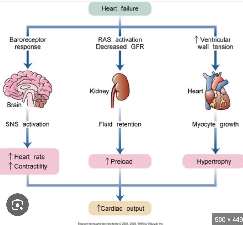 <p>Low CO</p><ul><li><p><span style="background-color: transparent;"><strong>Compensatory Mechanisms:</strong></span></p><ul><li><p><span style="background-color: transparent;">Sympathetic activation → ↑ heart rate, vasoconstriction.</span></p></li><li><p><span style="background-color: transparent;">RAAS activation → angiotensin II → ↑ blood pressure & afterload; aldosterone → sodium/water retention → fluid overload.</span></p></li><li><p><span style="background-color: transparent;">Natriuretic peptides (ANP, BNP) attempt to counteract volume overload but are often insufficient.</span></p></li></ul></li><li><p><span style="background-color: transparent;"><strong>Structural Changes:</strong></span></p><ul><li><p><span style="background-color: transparent;">Ventricular dilation → increased wall stress → hypertrophy → ventricular remodeling → further dysfunction.</span></p></li><li><p><span style="background-color: transparent;">HFpEF: Stiff ventricle → impaired filling → low CO.</span></p></li></ul></li></ul><p></p>