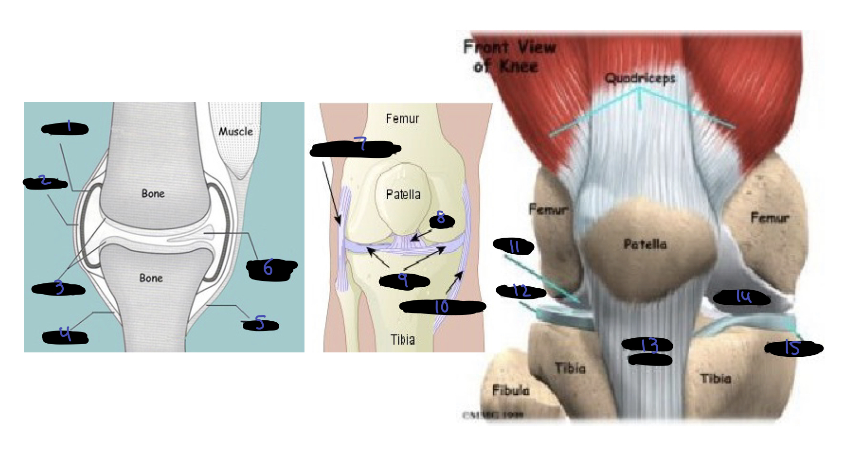 <ol><li><p>synovium</p></li><li><p>capsule</p></li><li><p>cartilage</p></li><li><p>ligament</p></li><li><p>tendon</p></li><li><p>meniscus</p></li><li><p>lateral ligament</p></li><li><p>ACL</p></li><li><p>meniscus</p></li><li><p>medial ligament</p></li><li><p>cartilage</p></li><li><p>meniscus</p></li><li><p>patellar tendon</p></li><li><p>cartilage</p></li><li><p>meniscus</p></li></ol>