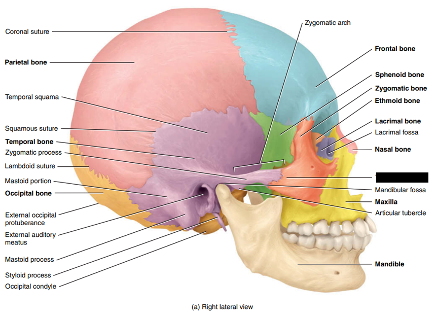 <p>State and identify what part of the cranial bone is being pointed out and censored. </p>