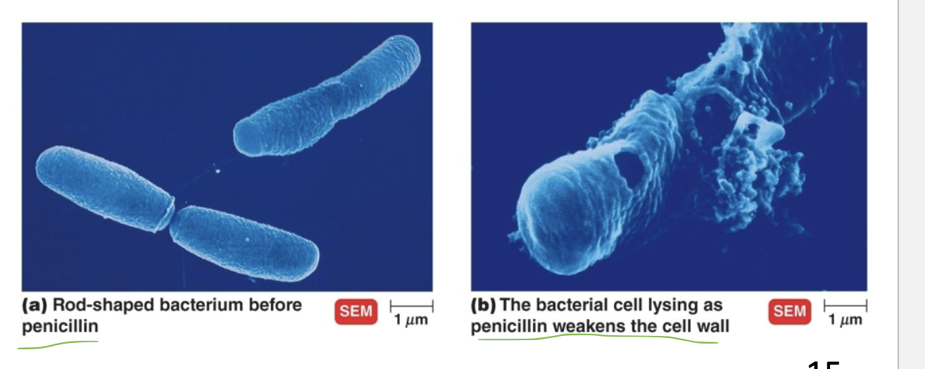 <p>The bacteria cell wall is weakened and unable to provide rigid support for the cell wall</p><p>Ultimately growing the cell lyse and dies </p><ul><li><p>weakens the cell wall till burst </p></li></ul><p></p>