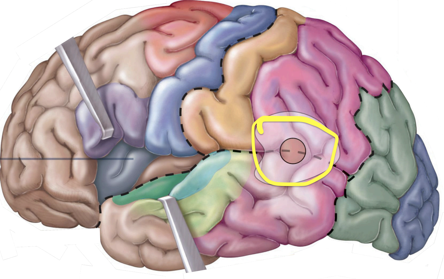 <p>Association Areas - <strong>Wernickearea (hearing)</strong></p>